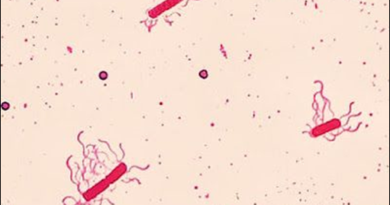 Flagella staining