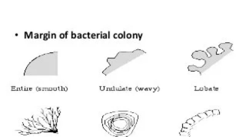 bacterial morphology