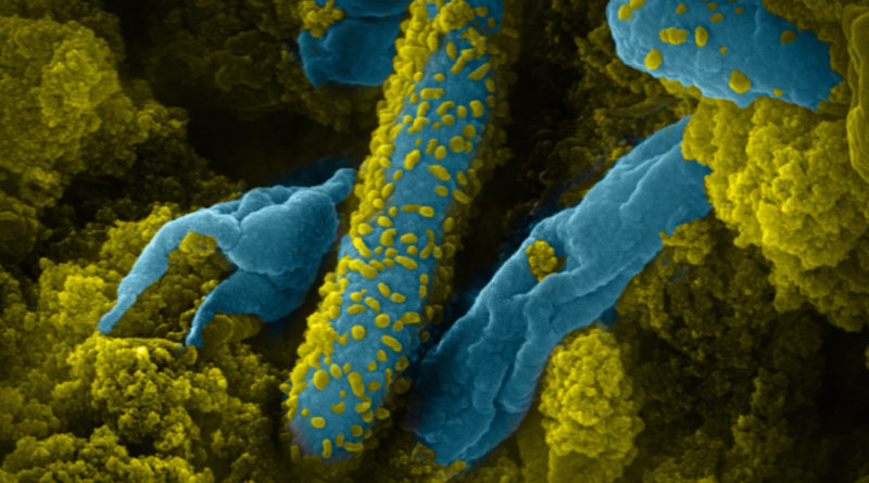 anaerobic bacteria
