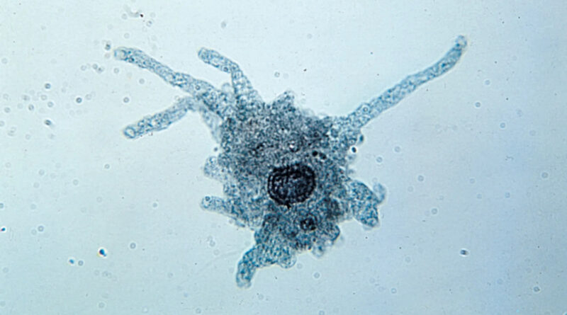 importance of protozoa
