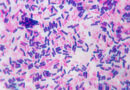 Gram staining is a fundamental microbiological technique that plays a pivotal role in identifying and classifying bacteria into two distinct groups: Gram-positive and