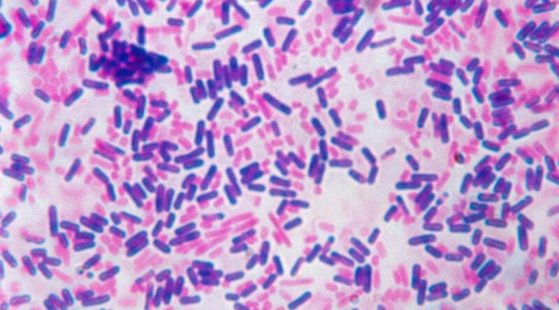 Gram staining is a fundamental microbiological technique that plays a pivotal role in identifying and classifying bacteria into two distinct groups: Gram-positive and