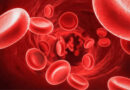 Haemophilia is a rare, inherited bleeding disorder that affects a person's ability to form blood clots properly. This condition, often referred to as a