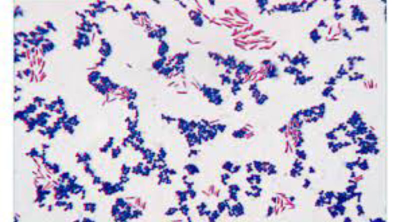 Gram staining, developed by Danish bacteriologist Hans Christian Gram in 1884, remains one of the most fundamental techniques in microbiology.