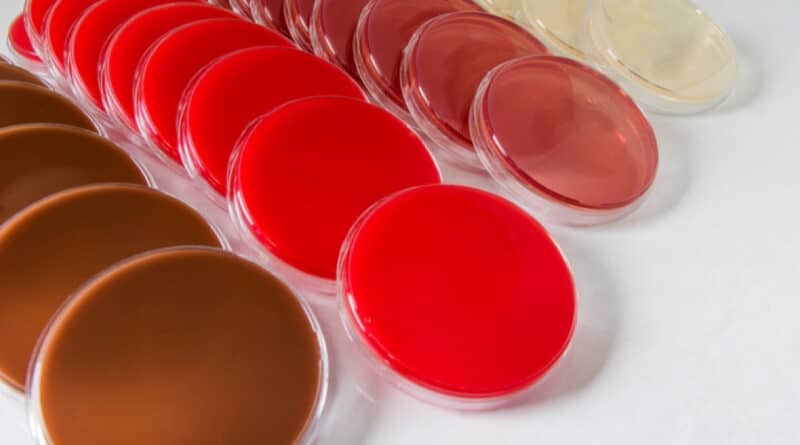 Microbiological laboratories play a pivotal role in the identification and study of microorganisms, ranging from bacteria to fungi. One essential component