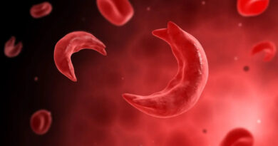sickle cell anemia in humans
