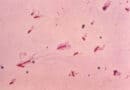 leifson staining method of flagella.
