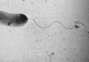 Cultural characteristics of vibrio cholera bacteria.