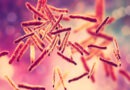 cultural characteristics of mycobacterium tuberculosis