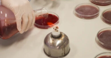 making of blood agar culture media