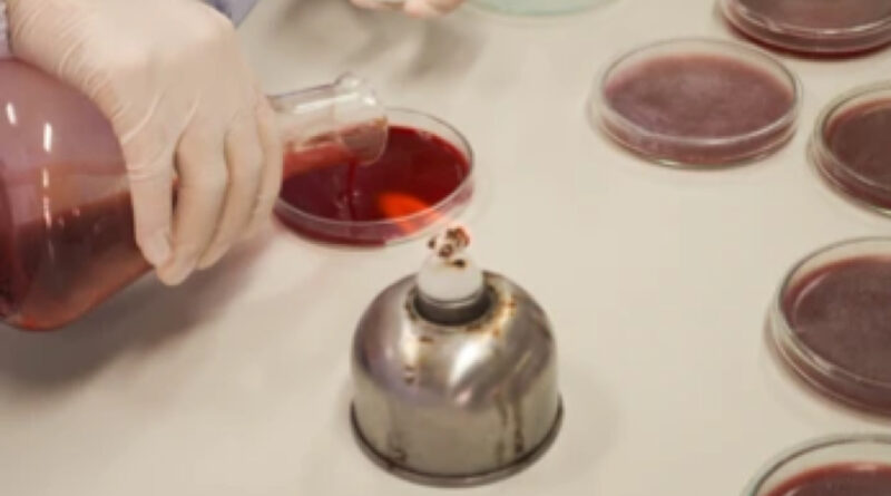 making of blood agar culture media